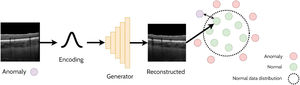 Overview of an example anomaly detection application in OCT images using GANs.