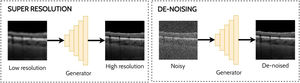 Overview of an example super-resolution application (left) and de-noising application (right) in OCT images using GANs.