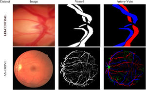 Sample images, vessel and artery-vein labels from LEI-CENTRAL and AV-DRIVE datasets. In both datasets, artery and vein pixels are labelled with red and blue colours, respectively. Undefined vessels in AV-DRIVE dataset are labelled in green colour.