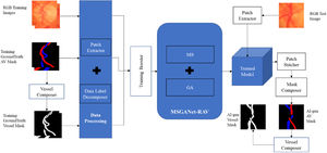Workflow of Automatic Deep-Learning based Vessel Segmentation and AV Classification.
