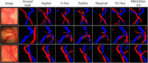 Semantic classification maps of the optic disc's central artery and vein pixels resulting from different deep segmentation architectures. Artery and vein pixels are labelled with red and blue colours, respectively.