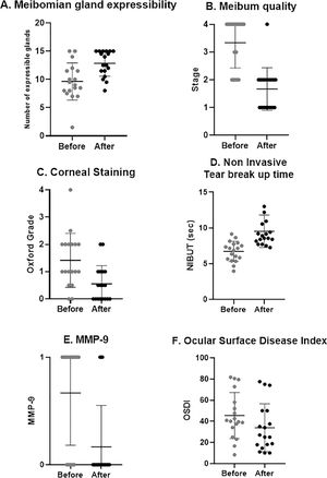 Clinical outcomes after treatment. A, number of expressible meibomian glands significantly increased (p = 0.001). B, meibum quality significantly improved (p < 0.001). C, corneal staining significantly decreased (p = 0.002). D, NIBUT significantly increased (p < 0.001). E, number of patients with positive MMP-9 test significantly decreased (p = 0.003). F, OSDI significantly decreased (p = 0.013).