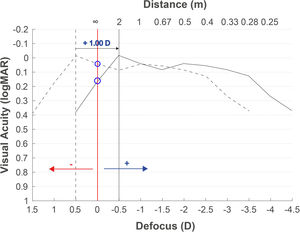 Expected defocus curve based on objective refraction to obtain the subjective refraction. A defocus curve hyperopic shift will be obtained when the refraction provided by the autorefractometer is used, due to the myopia overestimation. Adding a positive lens of +1.00D or higher depending on the multifocal IOL, the best focus will be myopically shifted.