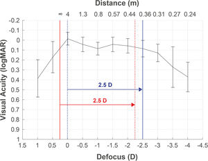 Defocus curve obtained from a patient with the best correction at 4 m (correction to infinity not applied). A refracted sample at 4 m (blue dotted line), without the adjustment to infinity (red solid line), will obtain poorer infinity vision and better vision at 40 cm (red dotted line) than the measured by the defocus curve at −2.5D (blue solid line).