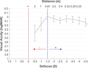 Defocus curve shifted to the right when positive lenses are added or a myopic target is selected, and to the left when negative lenses are added or hypermetropic target is selected.