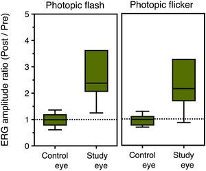 Box plots of ERG amplitude ratio (amplitude post / amplitude pre SOR) for the control and the study eyes (N = 9) in photopic flash (left) and photopic flicker (right) conditions.