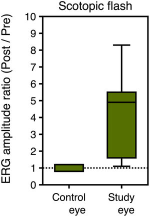 Box plots of ERG amplitude ratio (amplitude post / amplitude pre SOR) for the control and the study eyes (N = 9) in the scotopic flash condition.