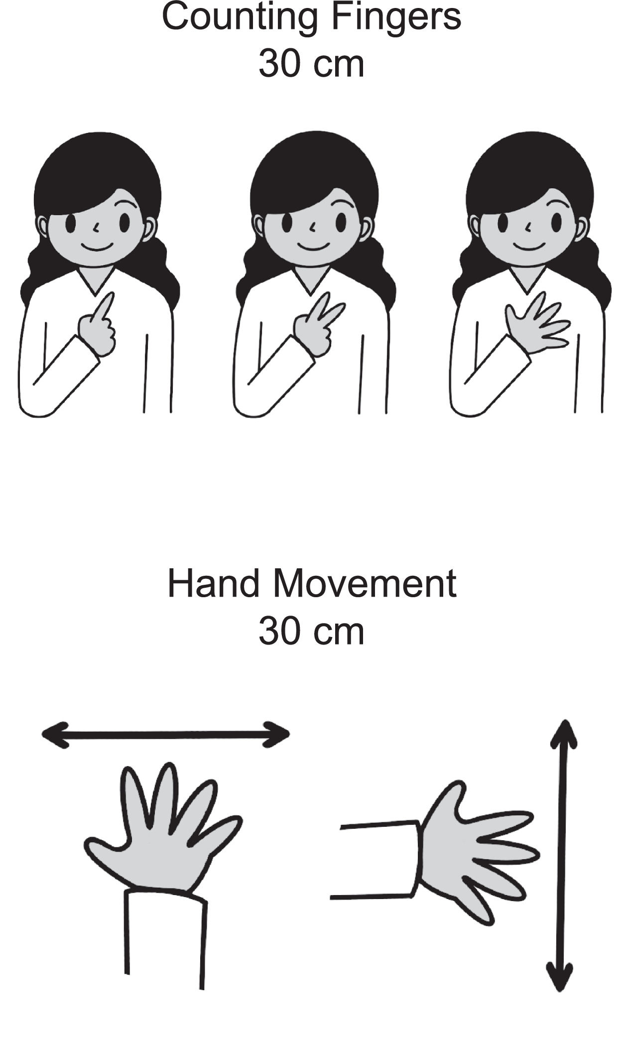 Quantification of visual acuity: “Counting fingers” and “Hand movement ...