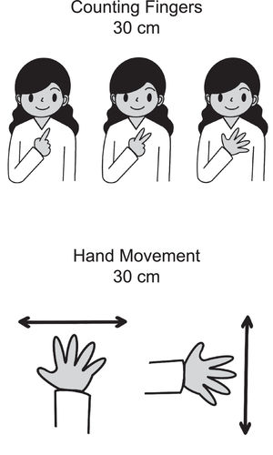 Schematic representation of Finger Count Test: counting fingers and hand movement with the distance from the patient during the assessment.