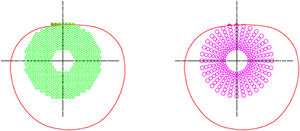 Representative diagram of intervention devices.