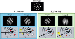 Retinal image simulations developed according to the JCCT. The blue dashed line indicates the orientation of the patient