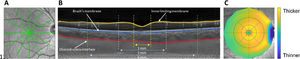Scan and segmentation protocol. A) High-resolution, six-line 30⁰ radial scans, centered on the fovea, were captured using enhanced depth imaging mode; B) Scans were segmented for the inner limiting membrane (yellow), Bruch’s membrane (blue), and choroid-sclera border (red) and analyzed for the central 1 mm diameter and 3 mm and 6 mm annuli; C) Choroidal thickness maps were generated post-segmentation.