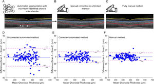 A) Automated segmentation was inspected for errors in identification of the choroid sclera border (white arrowheads); in this example, segmentation tightly hugged the major vessels while the segmentation of the other scan in the pair (not shown) included a portion of the suprachoroidal lamina along with the major vessels; B) manual correction of the automated segmentation; C) fully manual segmentation of the same scan; Bland-Altman analysis of repeatability of the choroidal thickness of the 1 mm diameter centered at the fovea obtained from two repeat scans (N = 122 pairs) for D) fully automated segmentation, E) after manual correction, when required, and F) the fully manual method. Solid blue lines represent the mean difference between the two scans; dashed pink lines represent the 95% limits of agreement, and black lines represent the inner and outer 95% confidence limits for the limits of agreement.