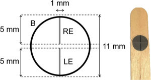 Left: Representation of the Nonius Linear Polarized Stimulus. B, binocular viewing; RE, right eye; LE, left eye. Right: Photograph of the stimulus created for this study.