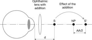 Optical effect of the addition lens in an emmetropic or distance vision corrected eye. The addition lens optically “moves” the stimulus (S) placed a distant d from the eye, to place S’ beyond de patient’s NP, so it can be seen comfortably by using only the half of the patient’s amplitude of accommodation (AA).
