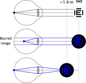 An illustration of the benefit of using blue visual stimuli to avoid impractically far face-device distances. In the top panel an emmetropic eye forms an image of a white stimulus placed far away on the retina. In the middle panel the stimulus color is just changed to blue, and the same eye forms a blurred retinal image similar as a 0.7D myopic eye. In the bottom panel the object is brought closer to the same eye, to a distance of 1.42 m (vergence of −0.70 D) allowing the eye to form a clear the image on the retina again.