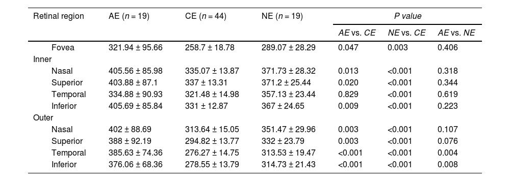 Tables