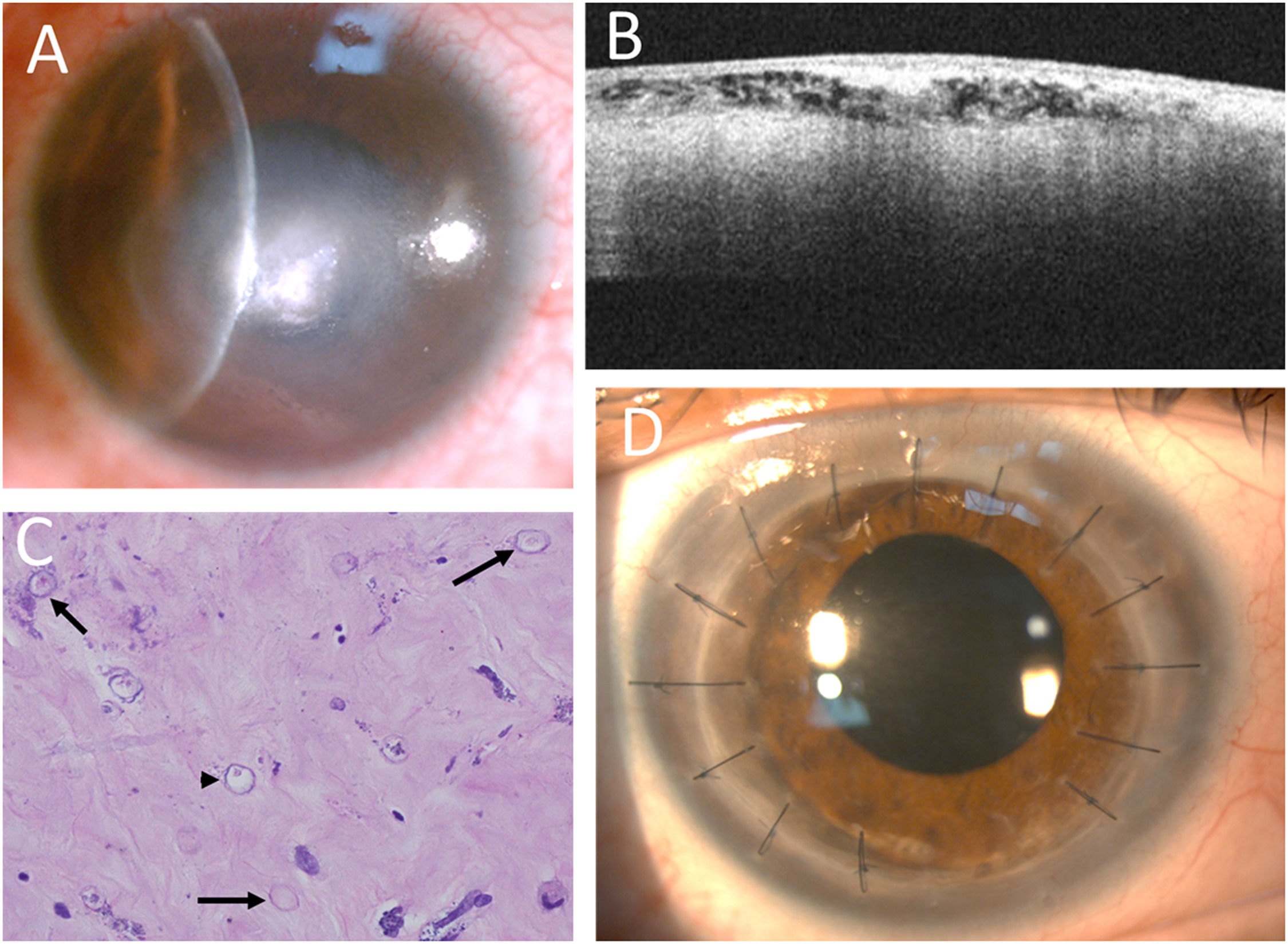 fig0003