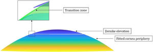 Visualization of corneal geometry. Zernike elevation corresponds to the original elevation data, which is fitted with the quadratic surface; Fitted corneal periphery: the peripheral cornea area is extrapolated using the quadratic function. Inset: Transition between the central and peripheral areas of the cornea using a smoothing algorithm.