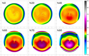 Anterior curvature changes during keratoconus evolution for Case 1 with a 2-mm weakness located of 1 mm inferiorly, for local stiffness reductions from 0 % to 80 %.