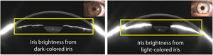 Example of brightness artifacts from iris reflections (yellow rectangles) in a dark-colored iris (left) and a light-colored iris (right).