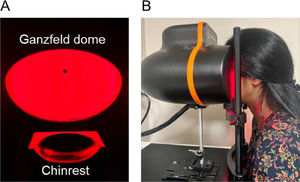 (A) A ColorDome (Espion, Diagnostics LLC) was used to deliver red light; (B) participant viewing red light with both eyes.