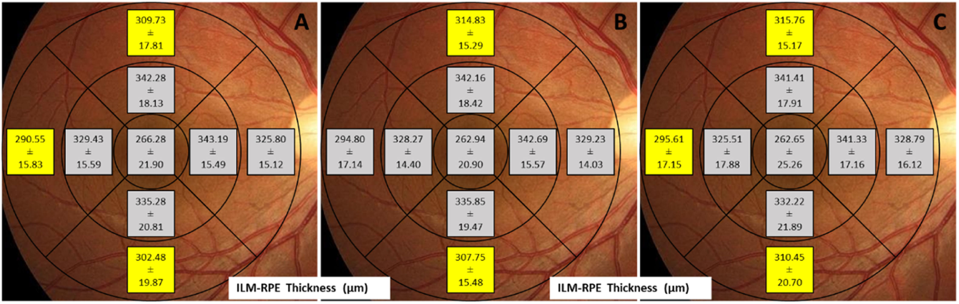 fig0001