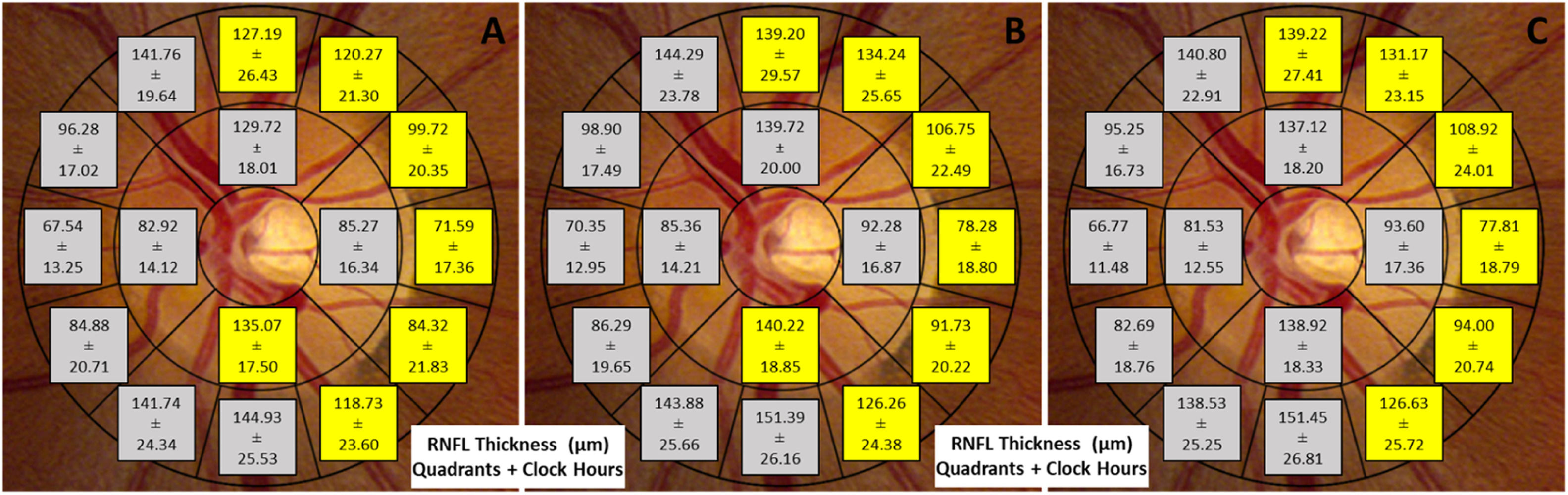 fig0003