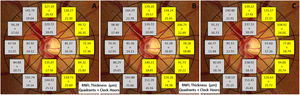 RNFL thickness at quadrants and clock hours for myopes (A), emmetropes (B) and hyperopes (C) eyes. The post-hoc statistical significance between the three refractive groups is shown in yellow (p < 0.050).