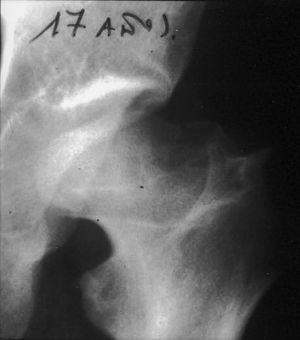 Resultado final: cabeza aplanada y elíptica.