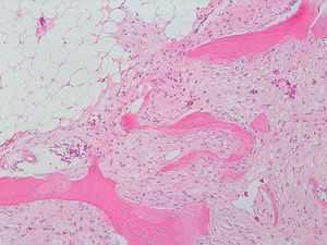 Imagen histológica en coloración de hematoxilina-eosina 40X que muestra células adiposas.