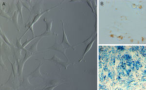 A) ADMSCs en cultivo. B) ADMSCs marcadas con SPIO. C) Tinción azúl de Prusia mostrando el marcaje férrico en el interior de las células en cultivo.