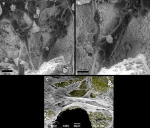 a y b. Preosteoblasto de ratón MC3T3-E1 creciendo en cristal de hidroxiapatita, observado con microscopio electrónico de superficie. Las células se fijaron con formalina y deshidratadas antes de su observación en el microscopio electrónico. 5c. Preosteoblasto de ratón MC3T3-E1 creciendo en una estructura trabecular de titanio, observada a microscopio electrónico de superficie. A la superficie de titanio se le ha dado un color gris para resaltar el contraste.