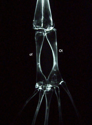 Imagen radiográfica de la extremidad posterior del Xenopus of: os fibulare, o astrágalo; Ot: os tibiale, o calcáneo.