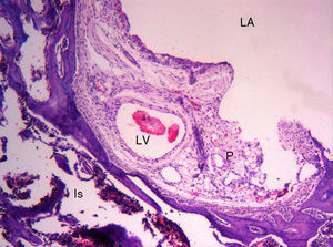 Histofotomicrografía de un corte sagital del trasfondo acetabular de una rata de 3 semanas. Is: isquion; LA: luz articular; LV: luz vascular; P: pulvinar.