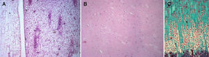 Histofotomicrogafía de: A) meristemo, planta liliácea Photos aureus (HE, ×100). B) cartílago, lucio (HE, ×100). C) cartílago de la placa crecimiento, rata (Masson, ×100).