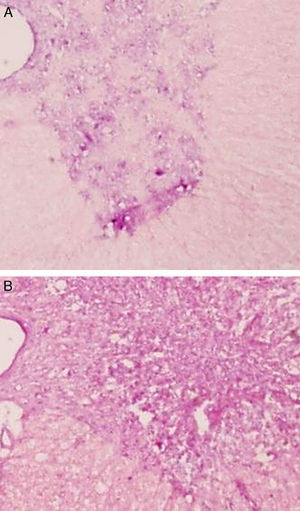 Lesión medular día 14 (H&E ×10, 12μ). Médula espinal torácica (A) y lumbar (B) del grupo no tratado. Vacuolización y pérdida neuronal severa más evidente en la zona lumbar.