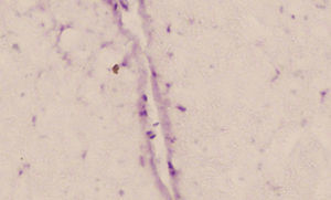 Imagen de una célula madre aislada marcada con BrdU en un conejo del grupo tratado con CMDG (×10).