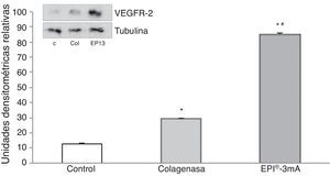 Histograma del análisis de la proteína VEGFR-2. Media±desviación estándar expresadas en unidades de densitometría relativas. El asterisco determina significación al comparar con el grupo control, y la almohadilla, al comparar con el grupo colagenasa.