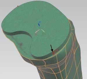 Modelo 3D de MEF de la tibia proximal con la bandeja tibial GENUTECH® de Surgival. Se observa la dirección de aplicación del par torsor (flecha).