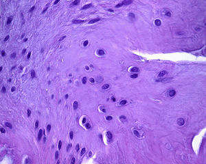 Hematoxilina y eosina (400X) de la biopsia tomada de la parte central del implante que muestra el crecimiento de fibrocartílago.