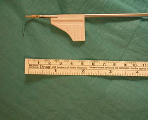 Dispositivo de anclaje óseo sin nudo PopLok 2,8mm (ConMed®, EE. UU.).