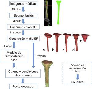 Proceso seguido para la reconstrucción y análisis por el método de los elementos finitos partiendo de las imágenes médicas. a) Vástago recto. b) Vástago con offset sin suplemento. c) Vástago en offset con suplemento. d) Vainas con vástago. e) Vainas sin vástago.