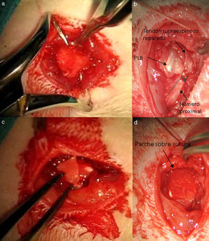 Reparación del tendón: a) realización del túnel transóseo; b) sutura transósea; c) parche de transportador rhBMP-2; d) sutura con transportador híbrido con rhBMP-2.