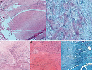 Tinción hematoxilina-eosina y tricrómico de Masson 50×: a) grupo I; b) grupo II; c) grupo III; d) grupo IV; e) grupo V.