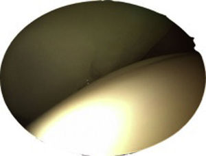 Imagen intraoperatoria de la cadera derecha desde el portal anterolateral del cartílago acetabular normal.