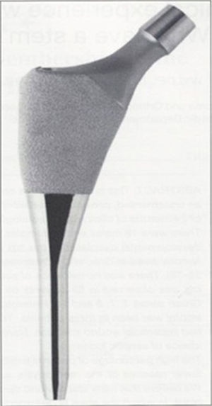 Vástago IPS (Depuy®, Warsaw, Indiana, EE. UU.). Fijación en metáfisis y tutor diafisario extrapulido.