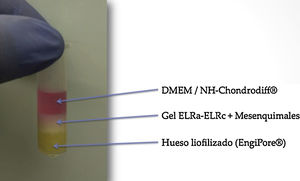 Disposición del cultivo celular. Fase inferior, hueso liofilizado; en el centro, gel de ERL con las MSC; en la parte superior, medio de cultivo DMEM.