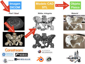 Fases del proceso de impresión 3D médica.