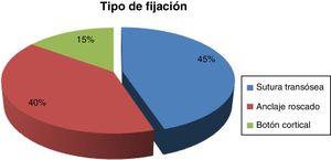 Tipos de fijación. La sutura transósea predomina en el 45% de los casos.